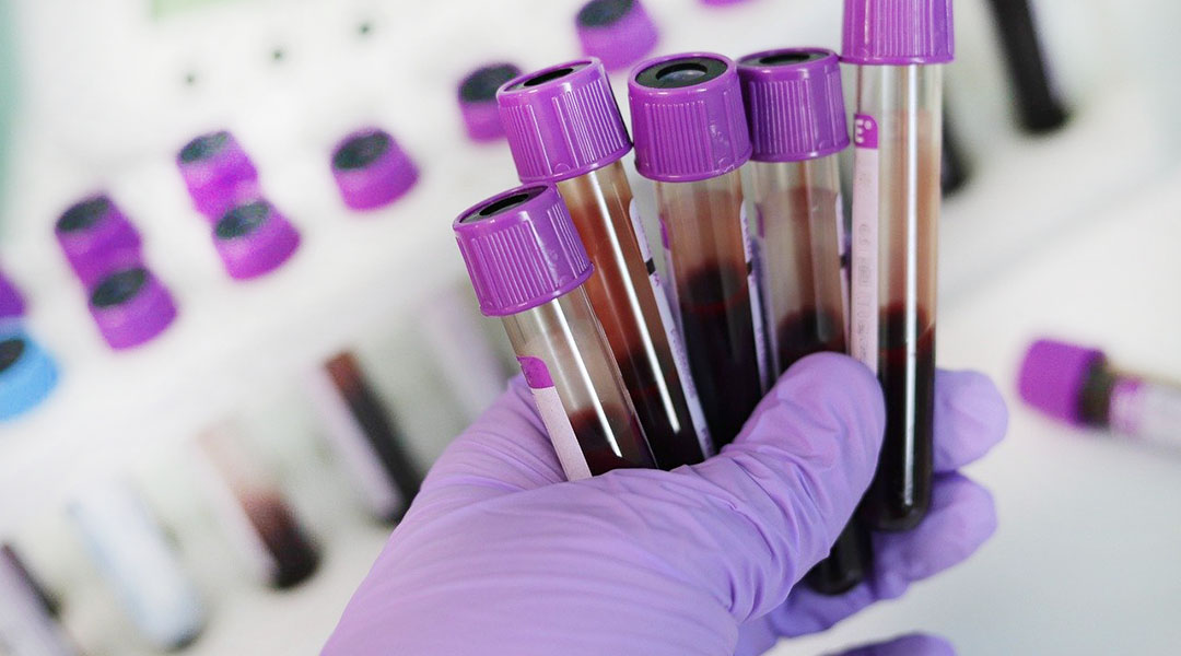 Premium Photo Express covid-19 test for igm and igg antibodies to novel corona virus sars-cov-2, covid-19. nurse or medtech hand in glove with coronavirus test stripes. purple neon background