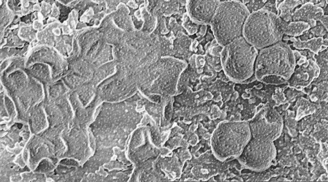 bacteria morphology