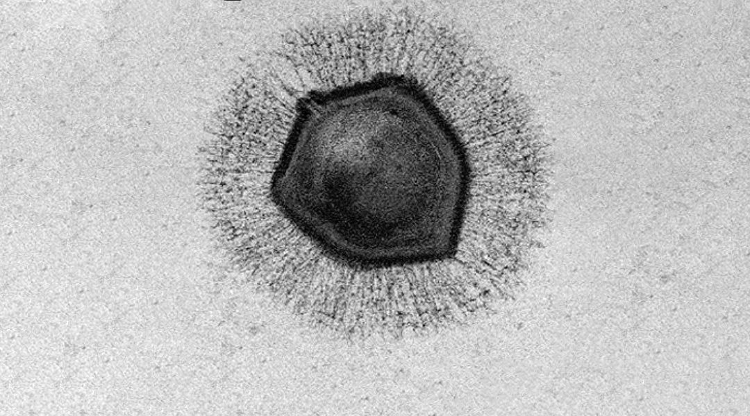 Understanding the mysteries of giant viruses