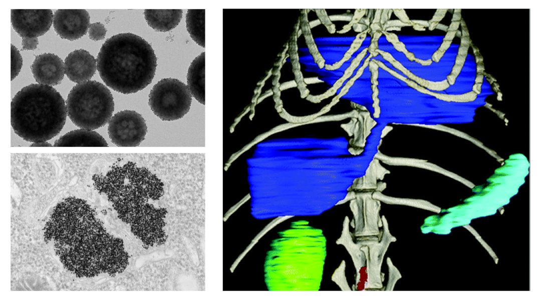 Combining nanoparticles with new X-ray technologies could revolutionize imaging diagnosis