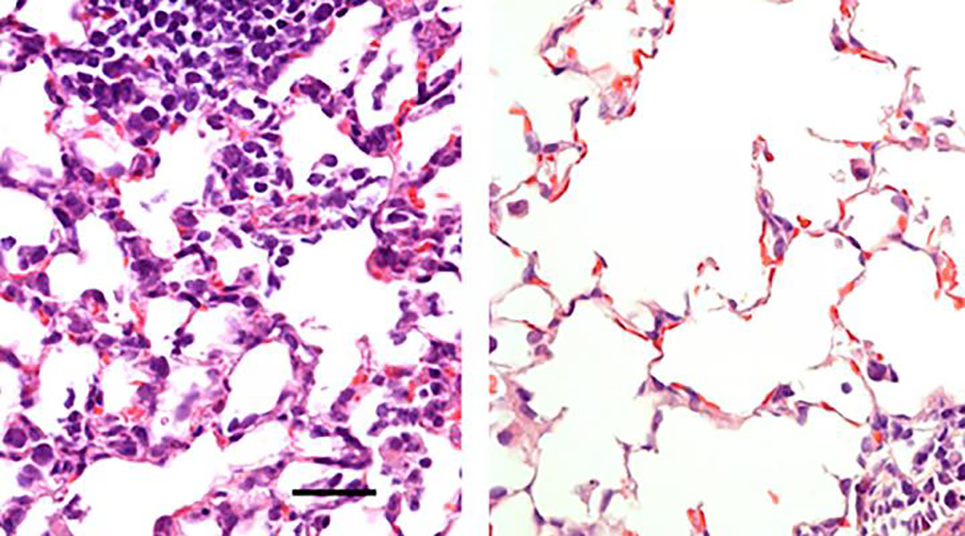 Nasal vaccine against SARS-CoV-2 prevents infection and spread throughout the body