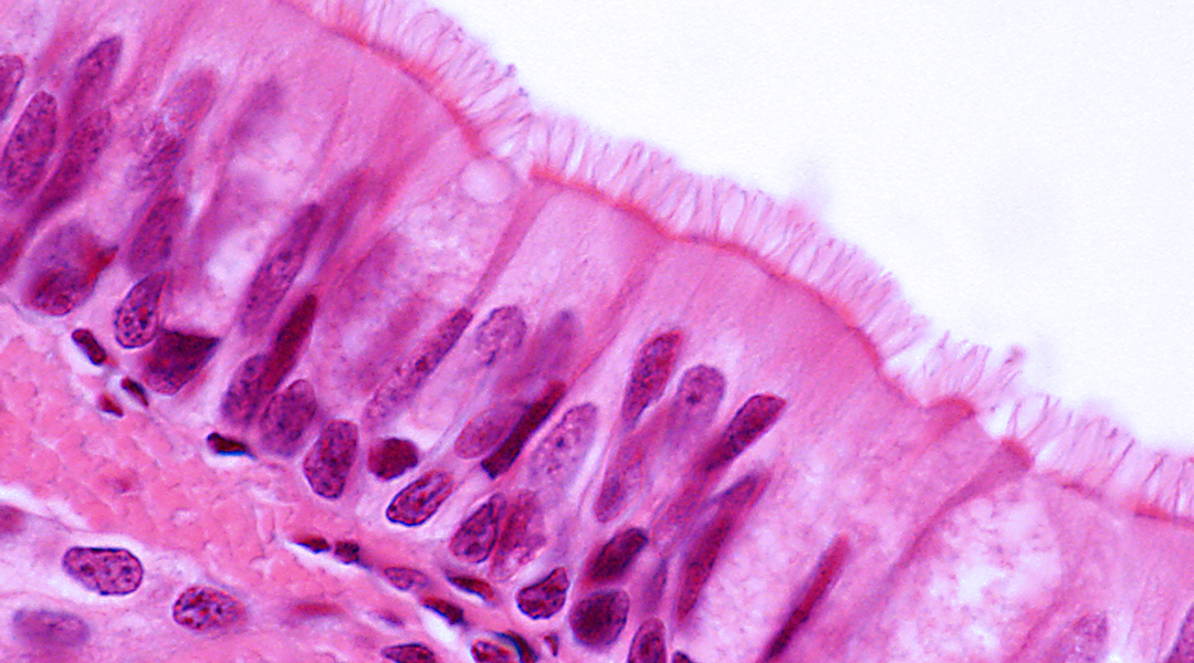 Treating tracheal defects using flexible polymeric biomaterials