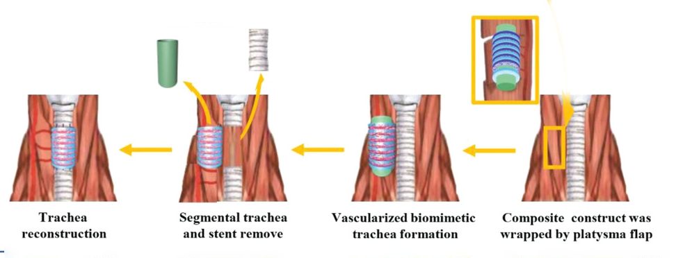 Respiratory