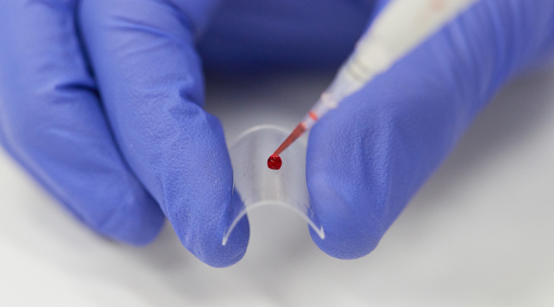 New test captures elusive blood biomarker to help identify severe COVID-19 before symptom onset