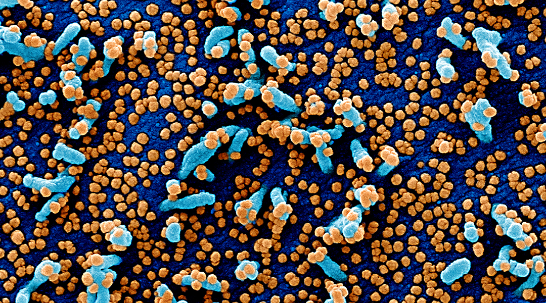 Coronaviruses mimic immune proteins and hide in plain sight