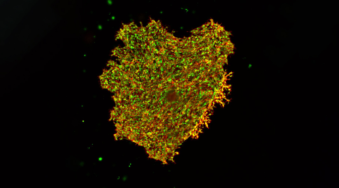 Mimicking mechanical properties of tissues to shed light on cancer cell behavior and migration