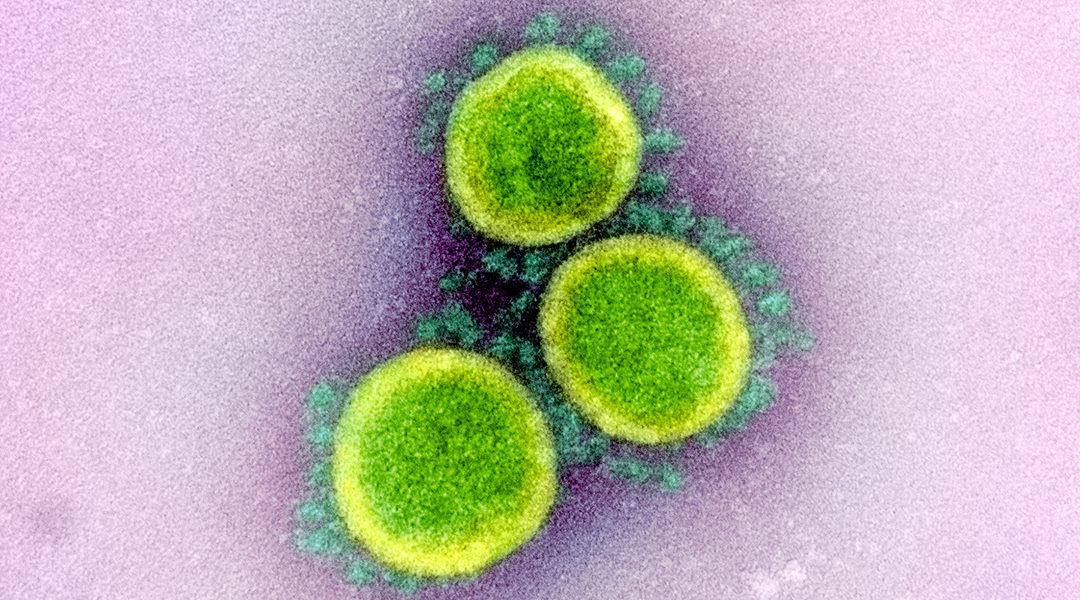 Lipid nanoparticles boost potential vaccine against SARS-CoV-2