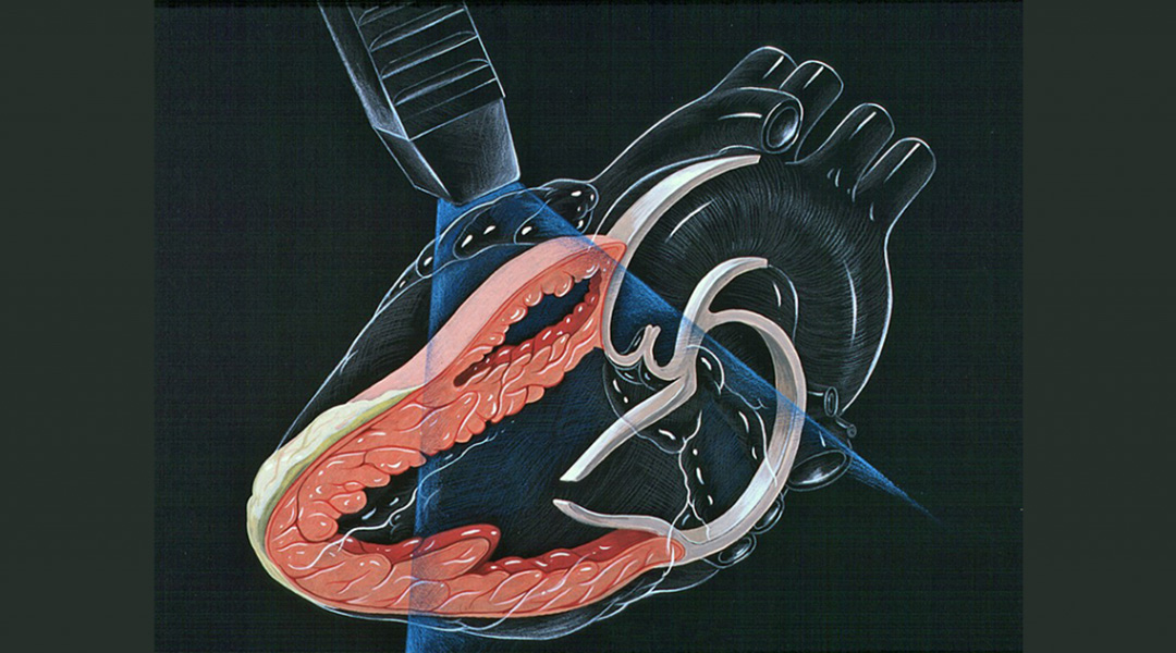 Insights into heart development with 3D bioprinting