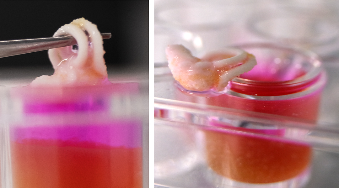 3D-printable bone replacements