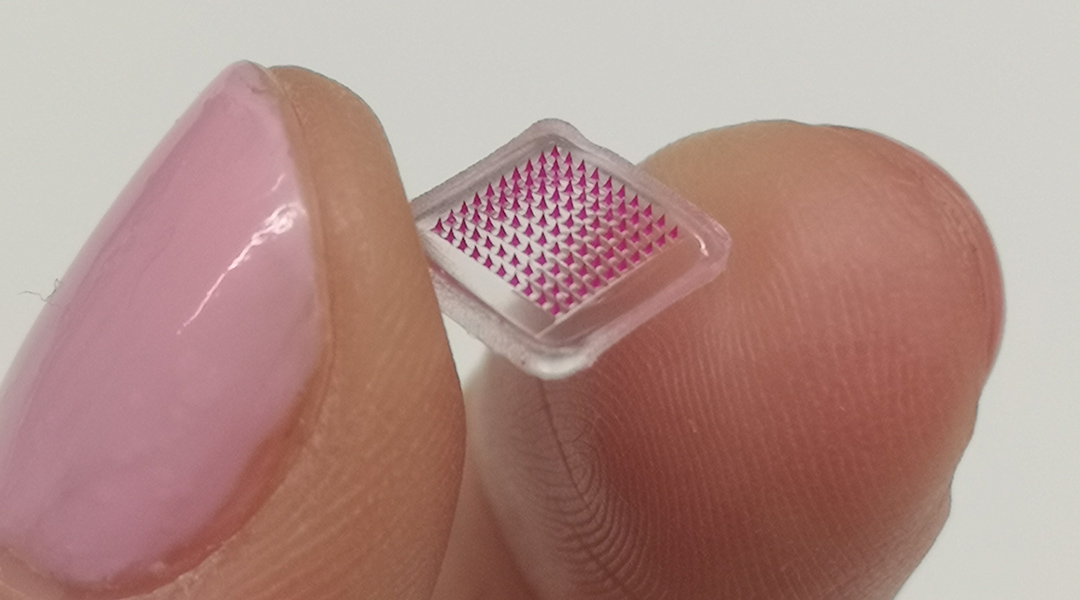 Microneedle patch delivers antibiotics locally in the skin