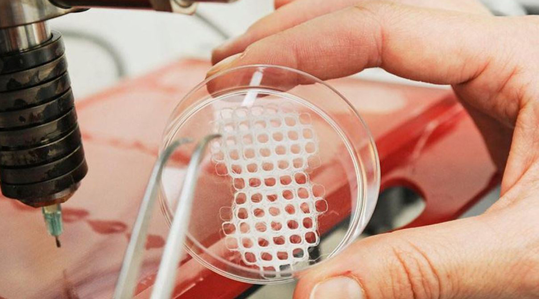 3D printers with “eyes and a brain” to advance body implants