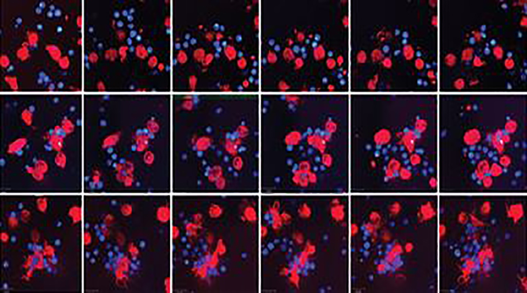 Graphene adjuvant improves efficacy of dendritic cell vaccines