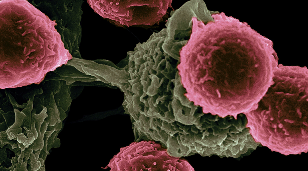 A needed boost for anti-tumor immunotherapy