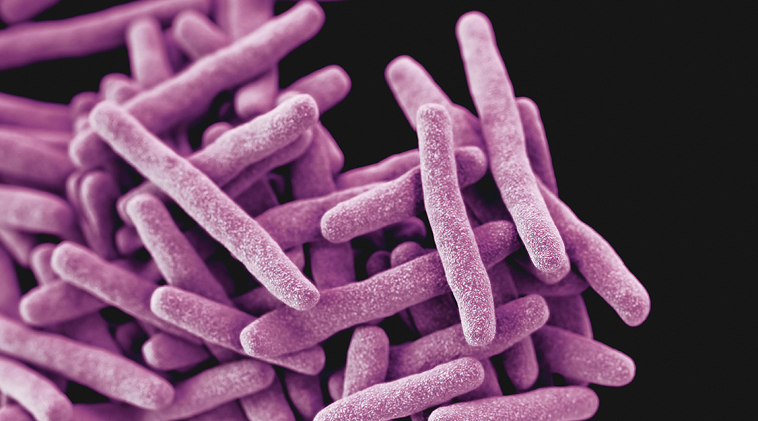 How our skin smells could be a sign of tuberculosis