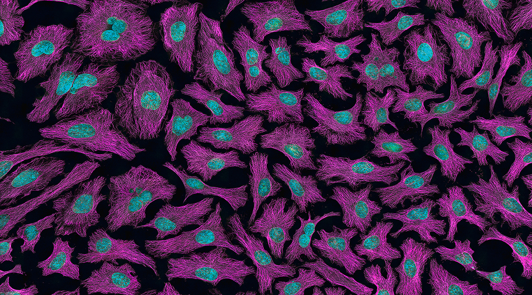 A DNA robot that walks on the surface of cells