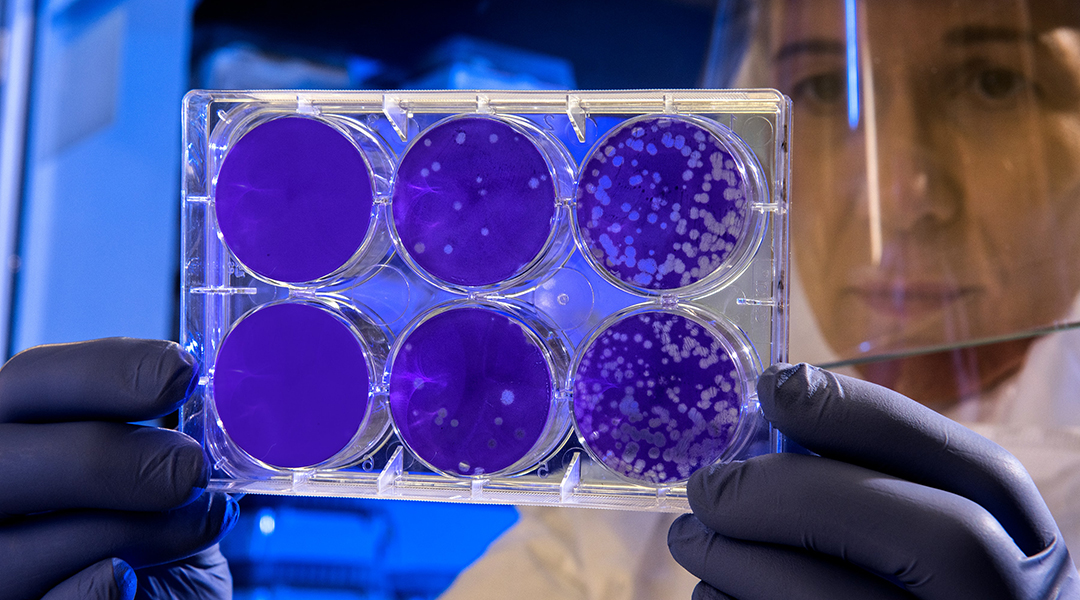 A scientist examines bacterial colonies in petri dishes