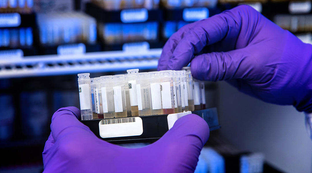 A scientist holds samples from COVID-19 patients