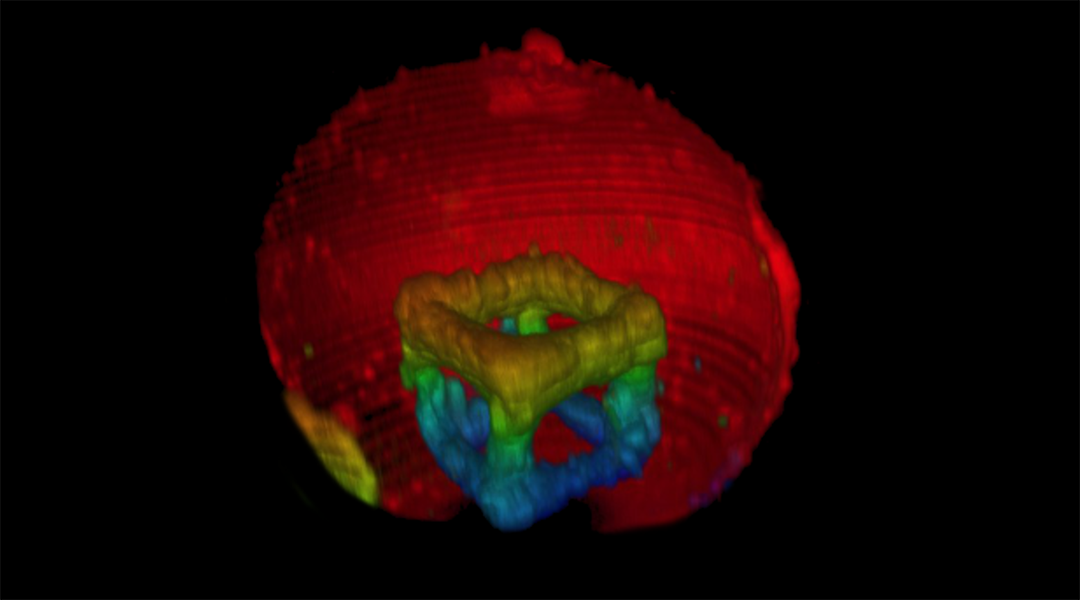 3D laser printing inside synthetic cells