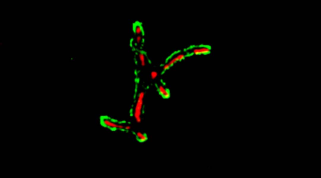 fluorescent probe for detecting tuberculosis