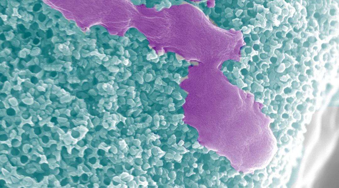 Urea-powered microrobots bust up bacterial films