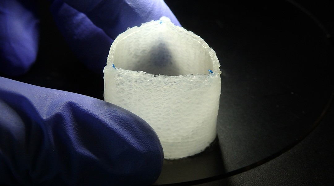 Artificial heart valves that evolve into a patient’s own tissue