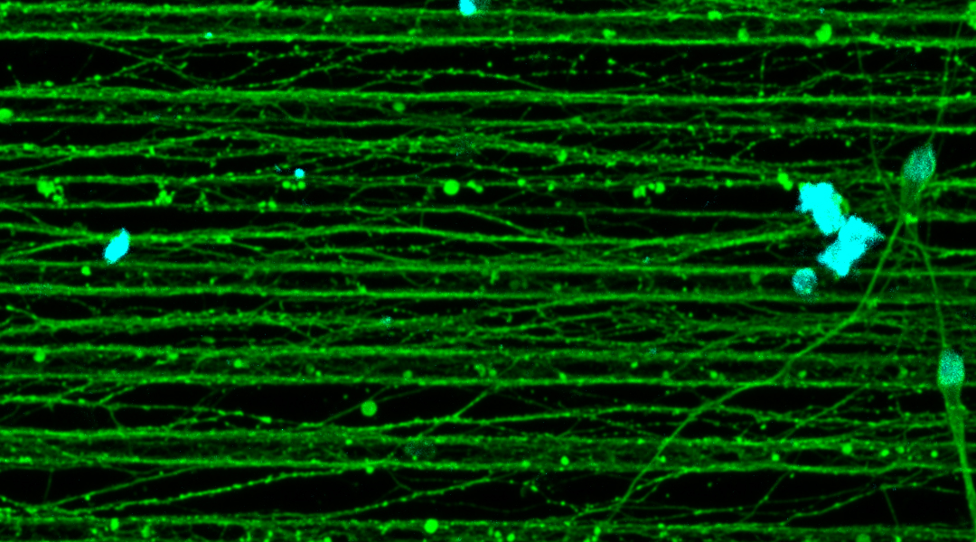 long nerve cells grown on a new platform