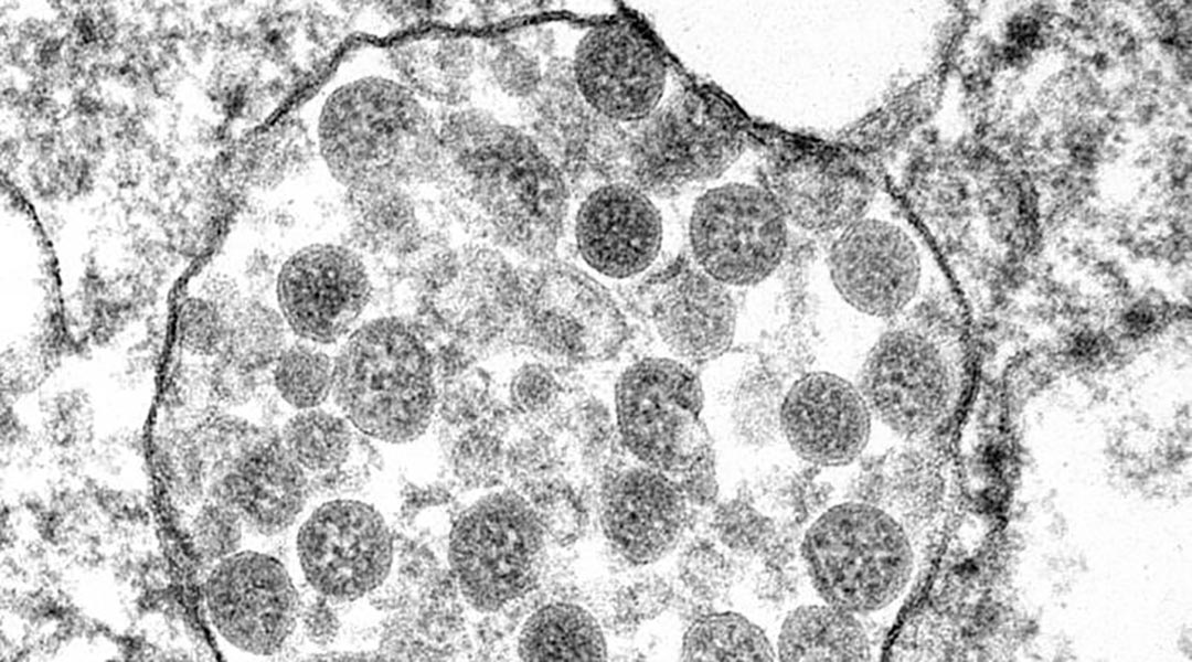 Transmission electron microscopy images of representative EV subpopulations