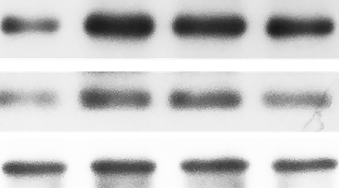 A Western blot.