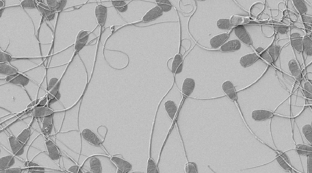 Copper nanoparticles an effective spermicide