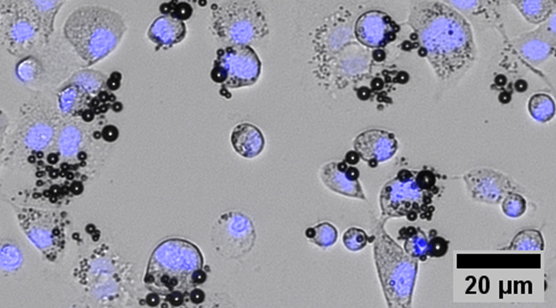 Image of microbubbles killing cancerous cells.