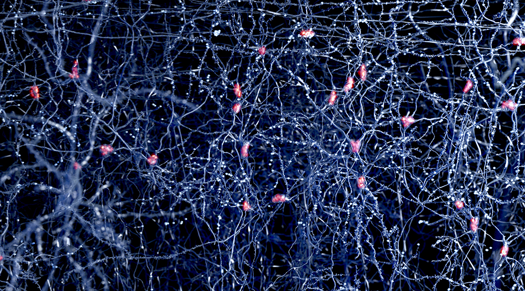 Image of neurons in the brain