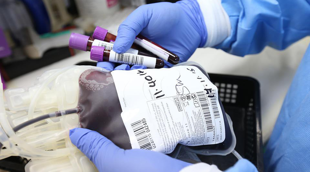 A blood transfusion bag held by a technician