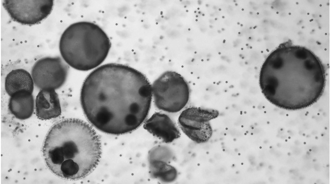 Algae-based microrobots fight cancer