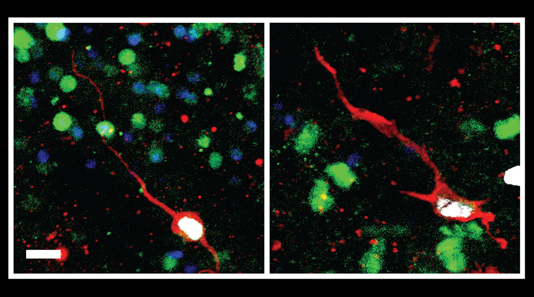 Old brains, new neurons