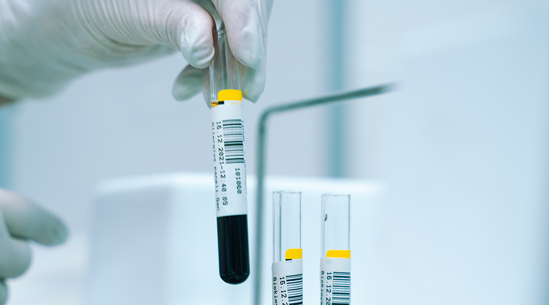 Blood samples in a lab