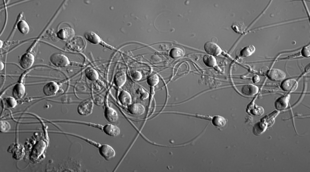 Sperm cells under a microscope.