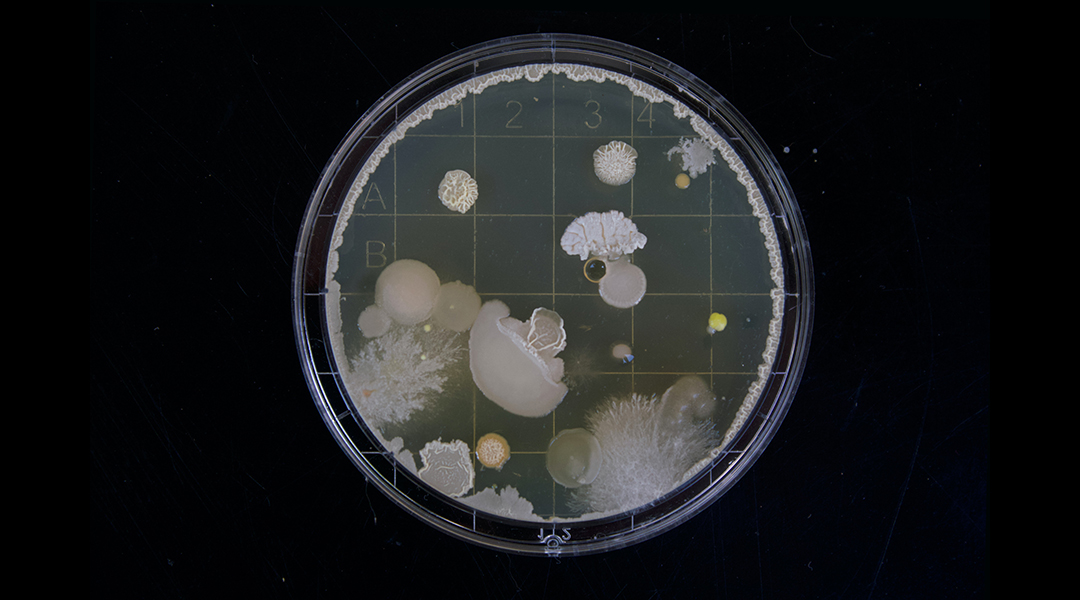 Bacteria gel on black background.
