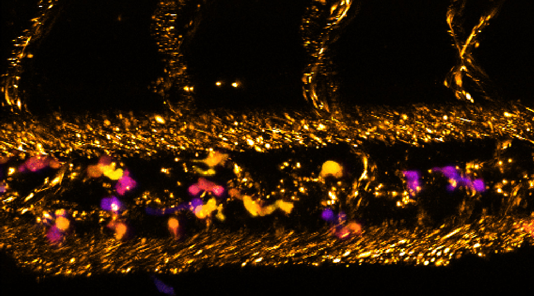 confocal image of a 2-day-old zebrafish larva that received intravenous injection of protocells (small dots represented in “gold” colour).