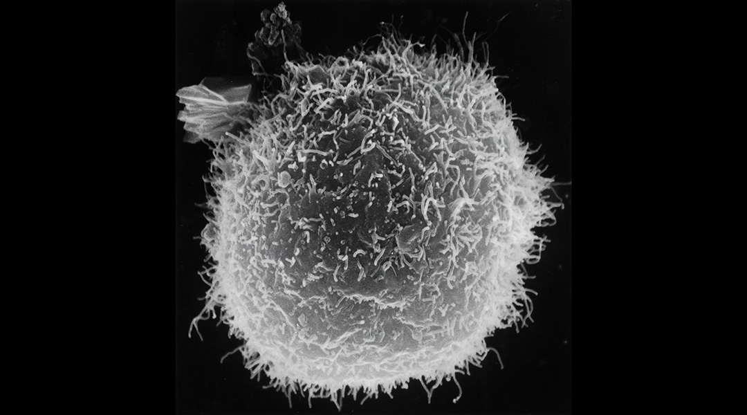 Image of a macrophage on a black background.
