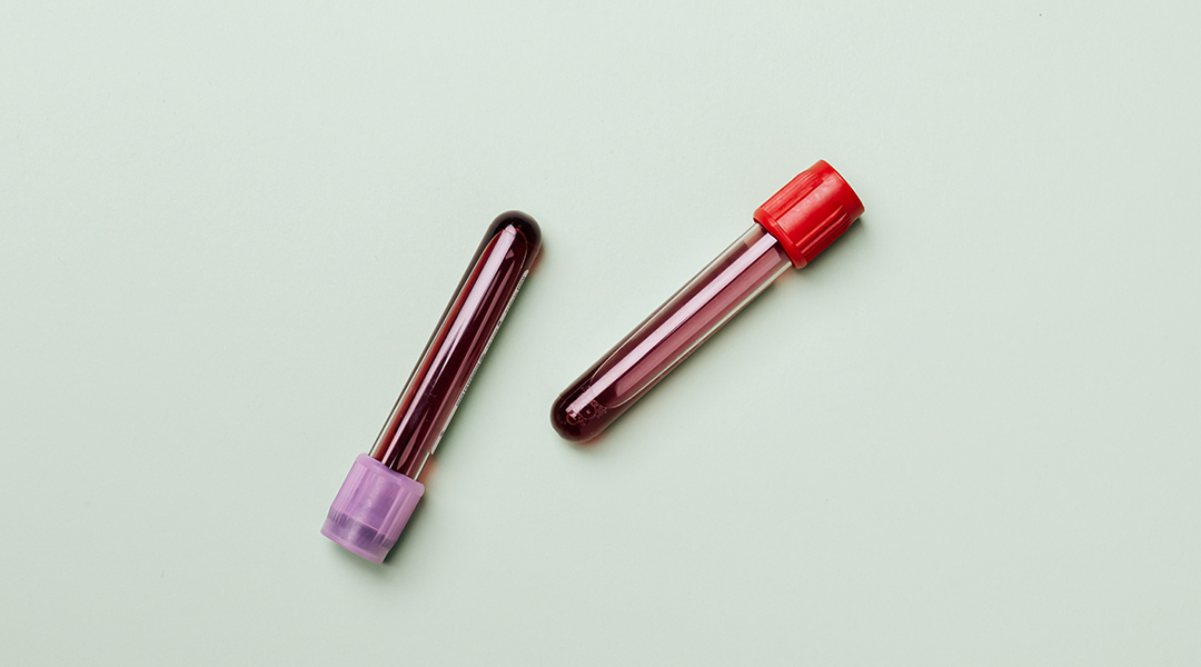 Blood samples on a green background.