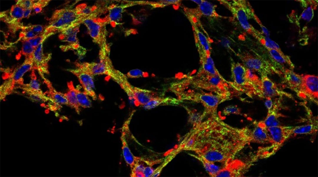 Inhaled “bubbles” help deliver drugs to the lungs