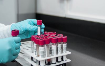 New blood test to diagnose Alzheimer’s disease via brain-derived protein