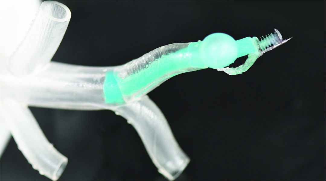 A soft robot to transverse the lungs.