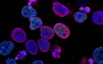 Dormant cancer cells camouflage to resist radiotherapy