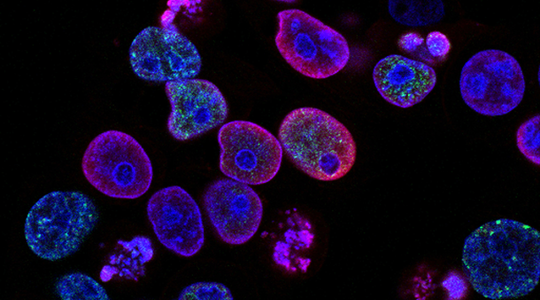 Dormant cancer cells camouflage to resist radiotherapy