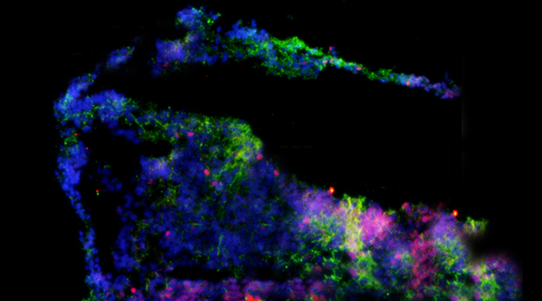 Brain organoid to better understand the brain.