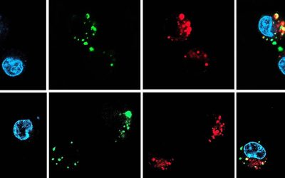 siRNA therapies delivered with oral nanocapsules