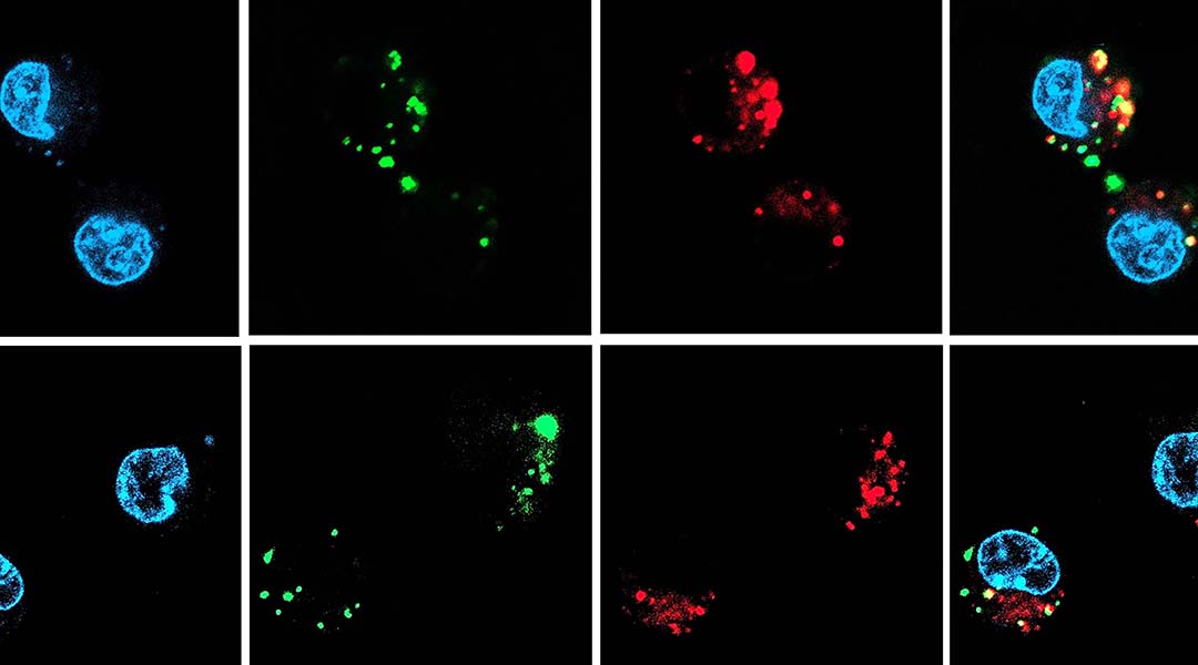 siRNA therapies delivered with oral nanocapsules