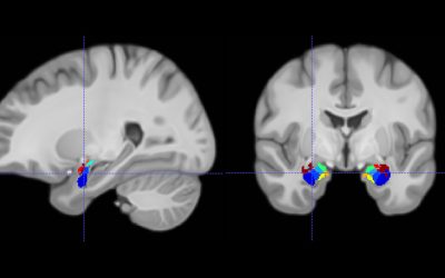 Why do our brains prioritize emotional memory?