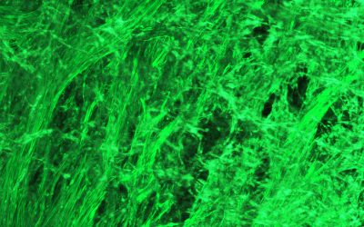 Decisive push brings the first artificial intestine closer